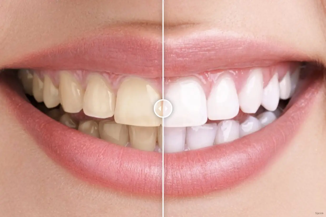 之前和之后的圖像比較WordPress插件